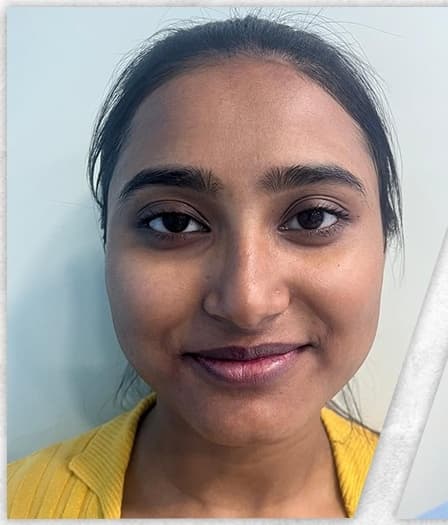 Instant Glow Facial — before