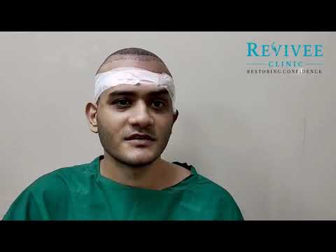 Hair Loss | Revivee Clinics | Girish Park